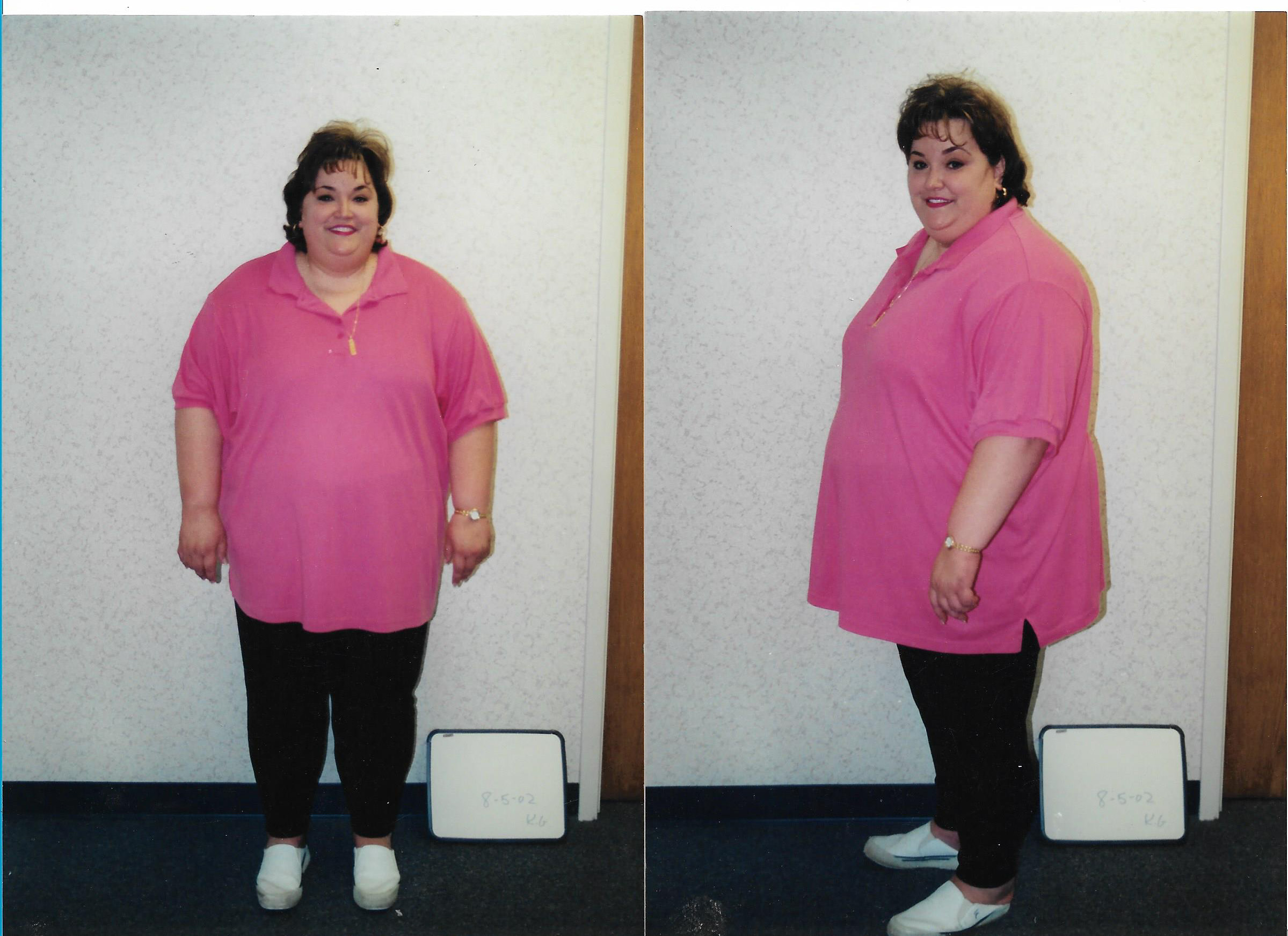 Troy resident Kelley Gunter, the author of the new book "You Have Such a Pretty Face," loss 243 with the help of weight loss surgery in 2002. She says true transformation came when he sought help for her destructive behavior. She lives with her son Alec and three Rottweilers.