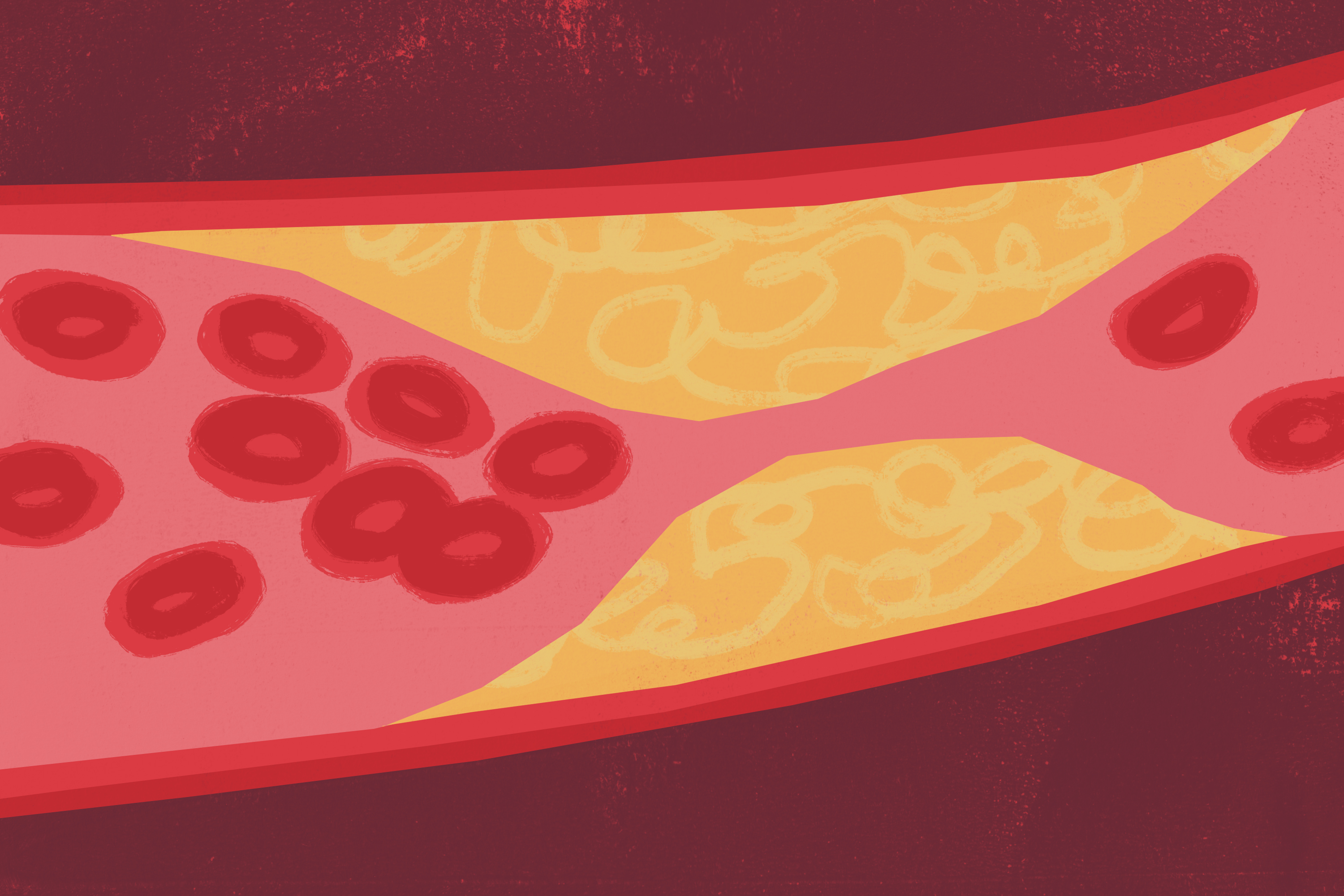 What does cholesterol do to your body? Here's what you should know –  Deseret News, image size:3000x2000