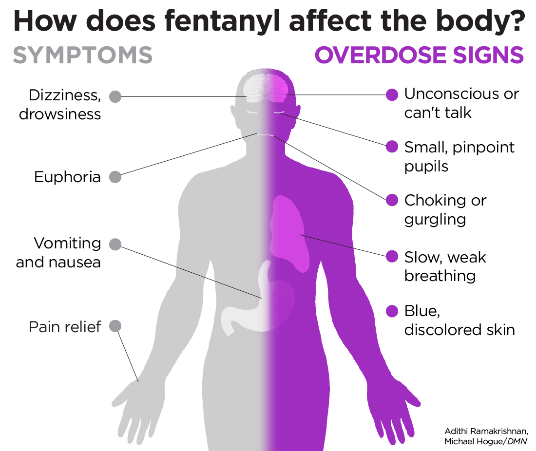 Health Problems and Long Term Side-Effects Of Fentanyl