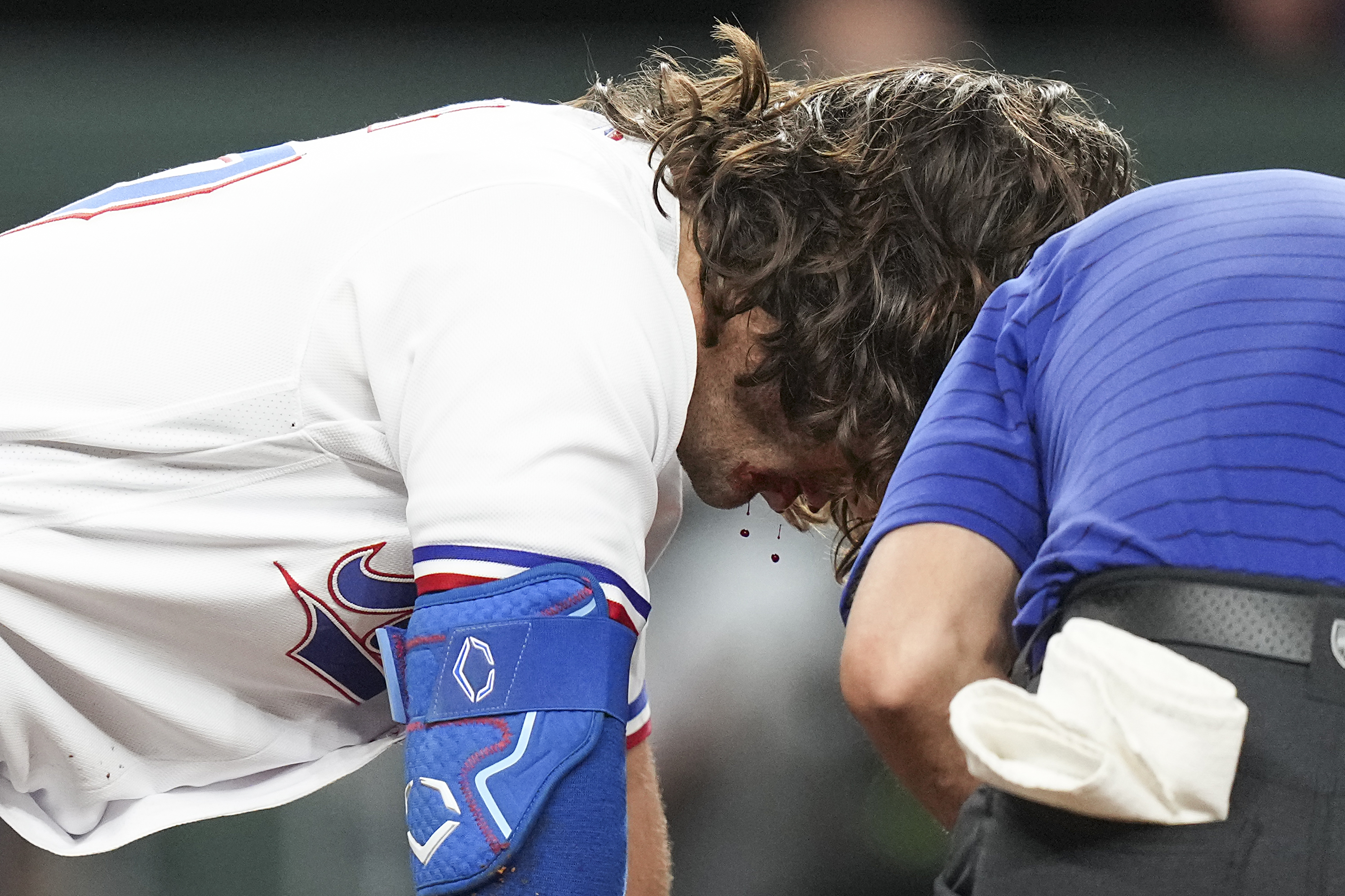 Rangers' Josh Smith got stitches, some swelling after pitch to face