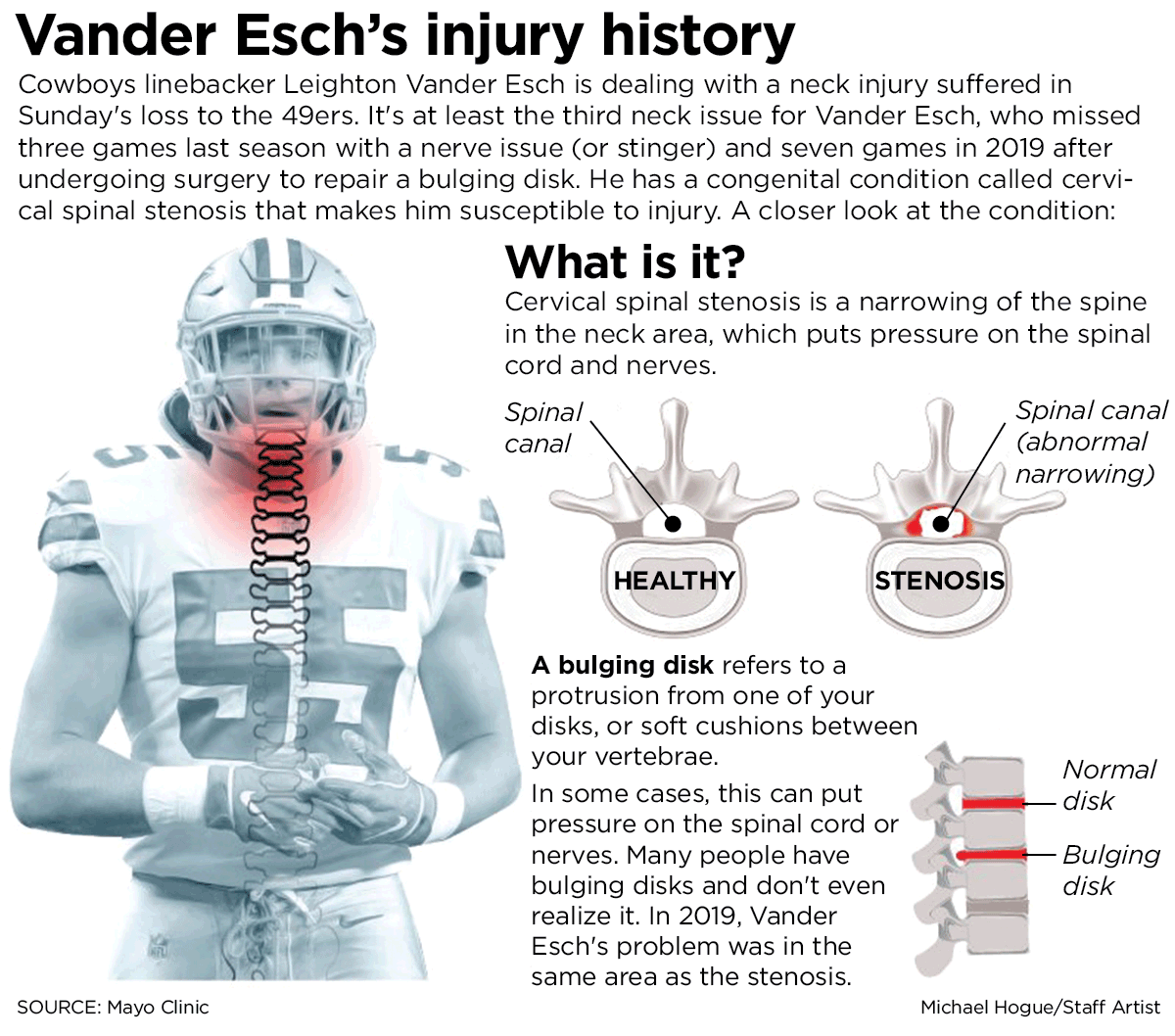Why does Leighton Vander Esch wear a neck brace? How Cowboys star plays in  the NFL with spinal stenosis