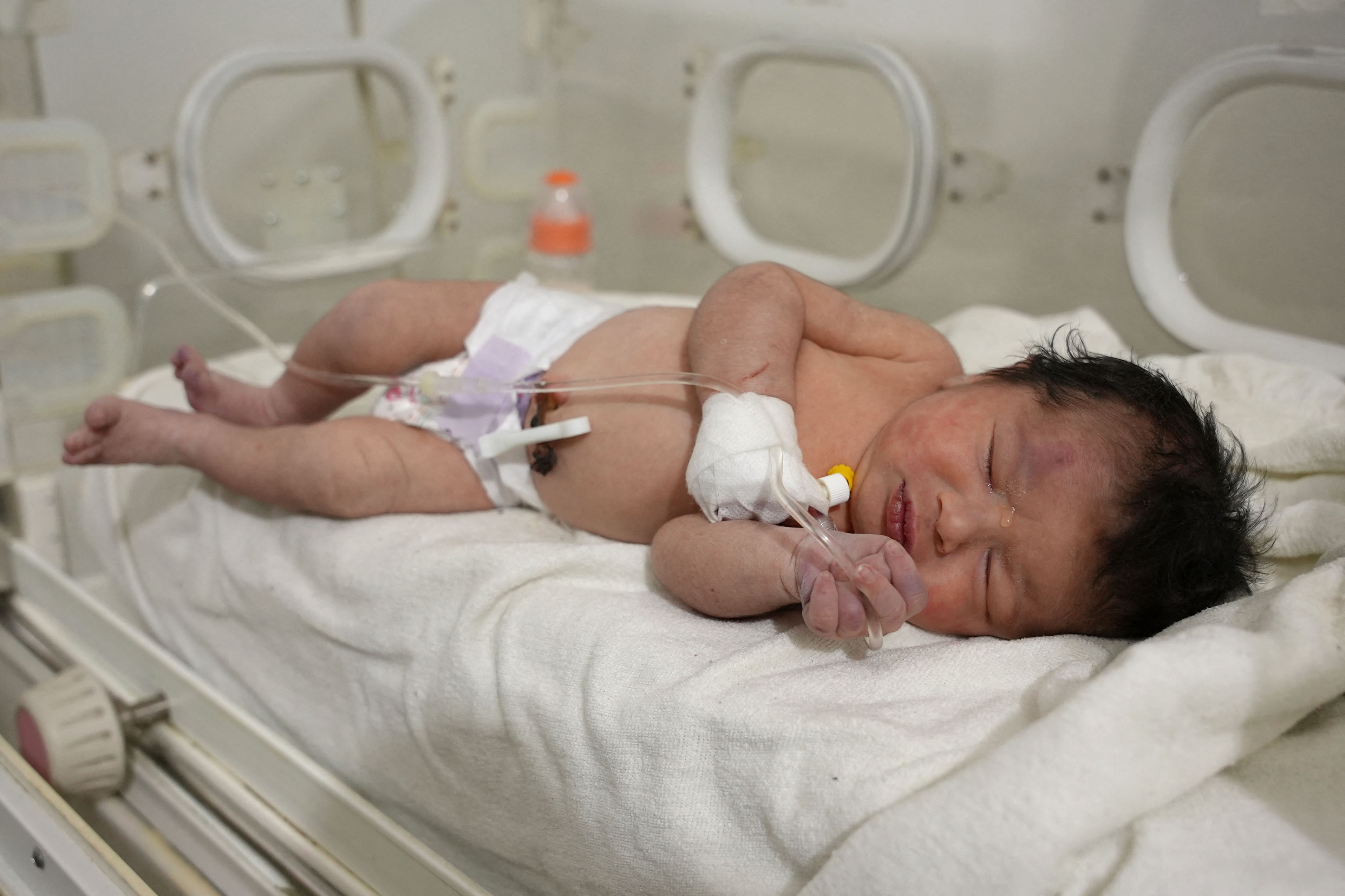 Una bebé recién nacida que fue encontrada todavía atada a su madre por el cordón umbilical permanece en un hospital de Siria. (RAMI AL SAYED / AFP).