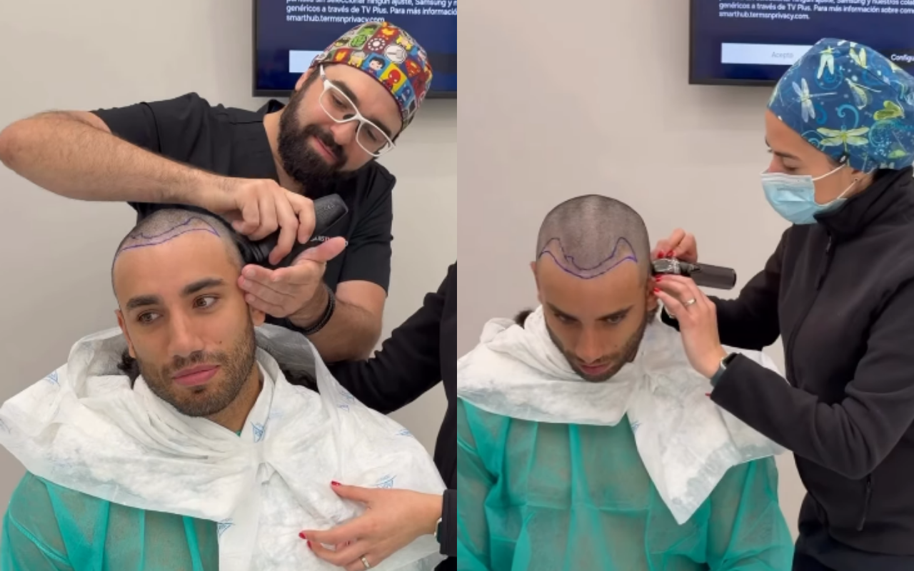 El chico 'reality' fue intervenido por profesionales capilares en España, quienes le realizaron un trasplante de cabello | Foto: Instagram (@saidpalao_fit) / Composición EC