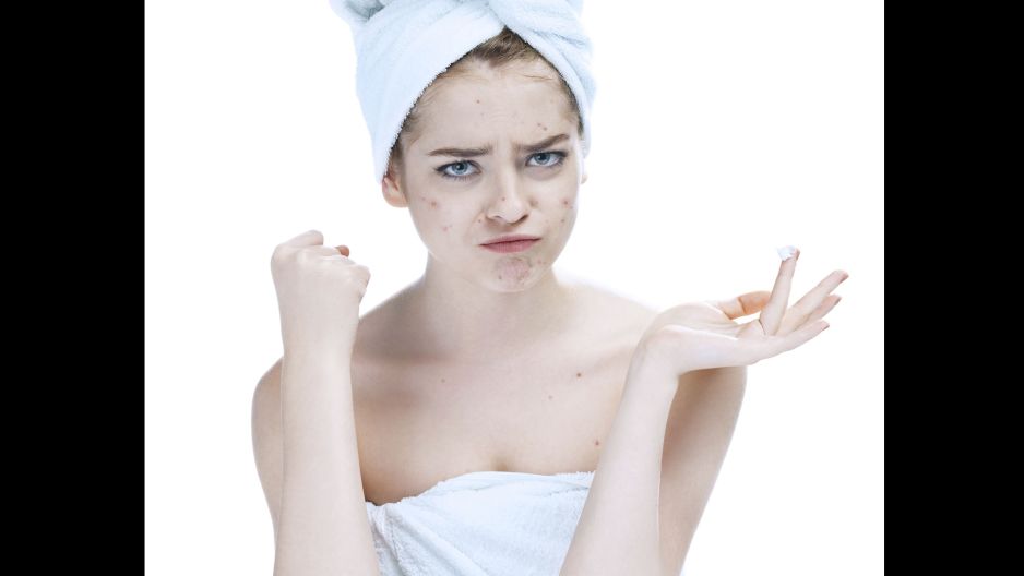 Combate el acné consumiendo estos alimentos FAMILIA