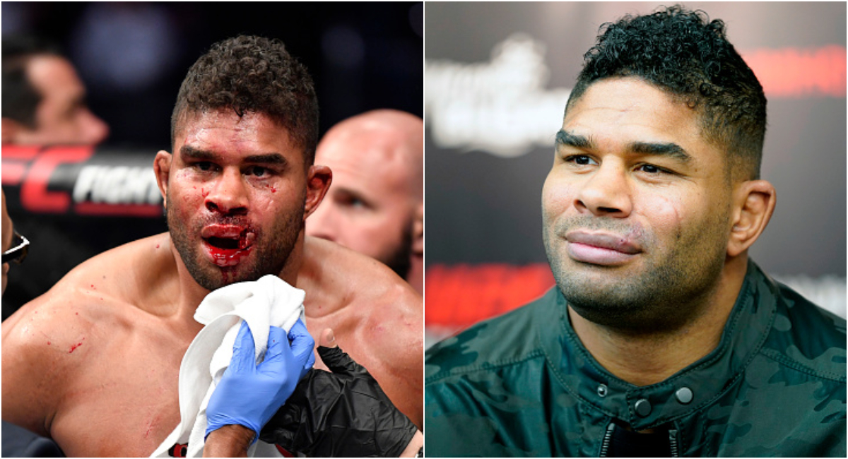 UFC Alistair Overeem Mostr C mo Qued Su Labio Partido Luego De Su ufc-alistair-overeem-mostr-c-mo-qued-su-labio-partido-luego-de-su