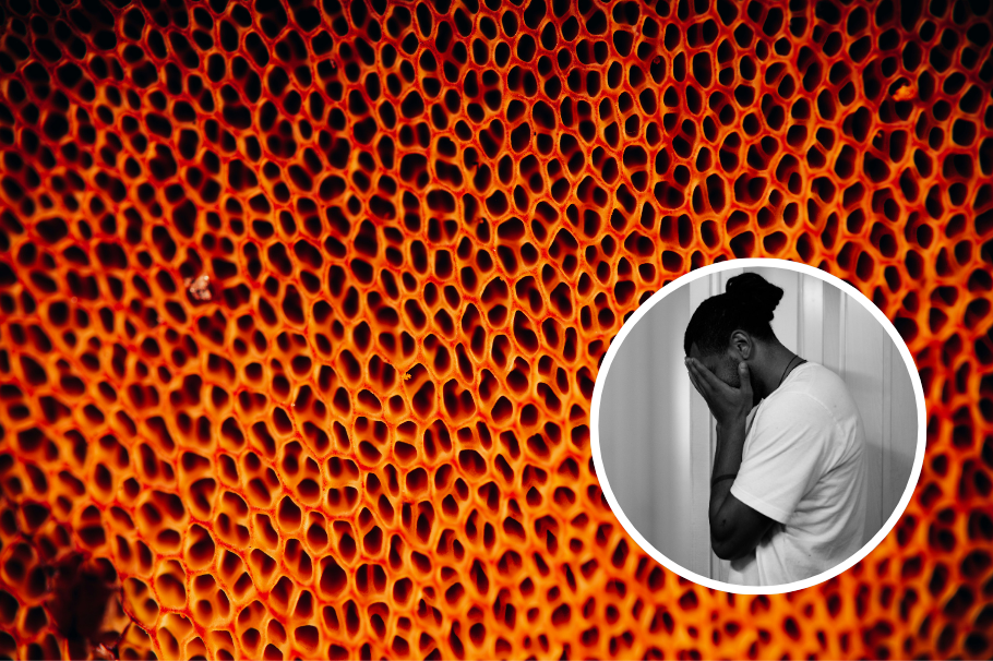 ¿Qué es tripofobia y agorafobia? Son las fobias más buscadas de Internet