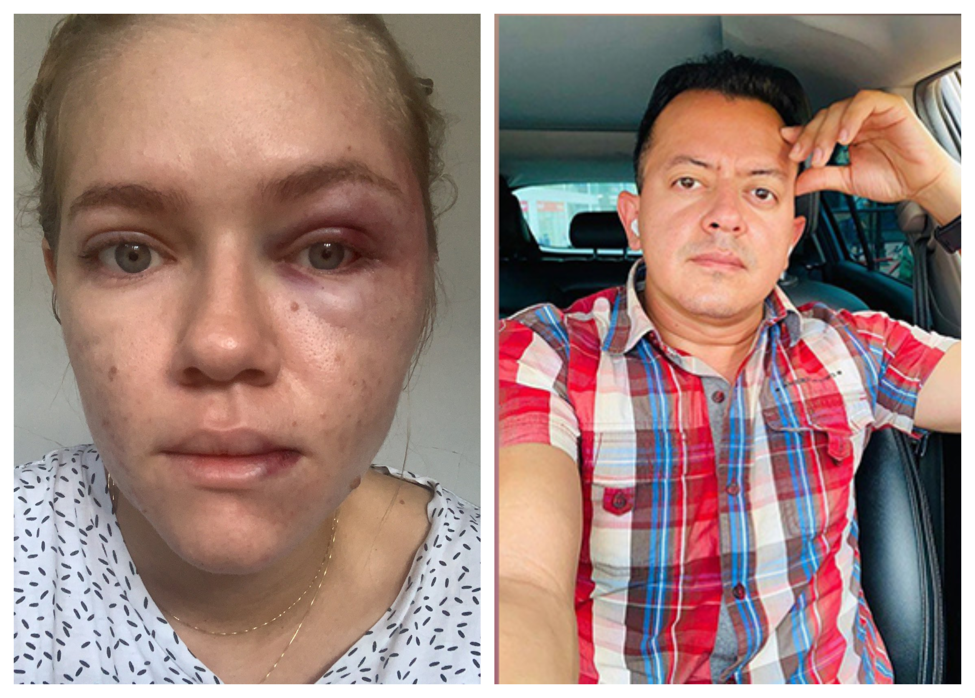 Alertan demora en denuncia por violencia contra el concejal de Ocaña Deiby Arias