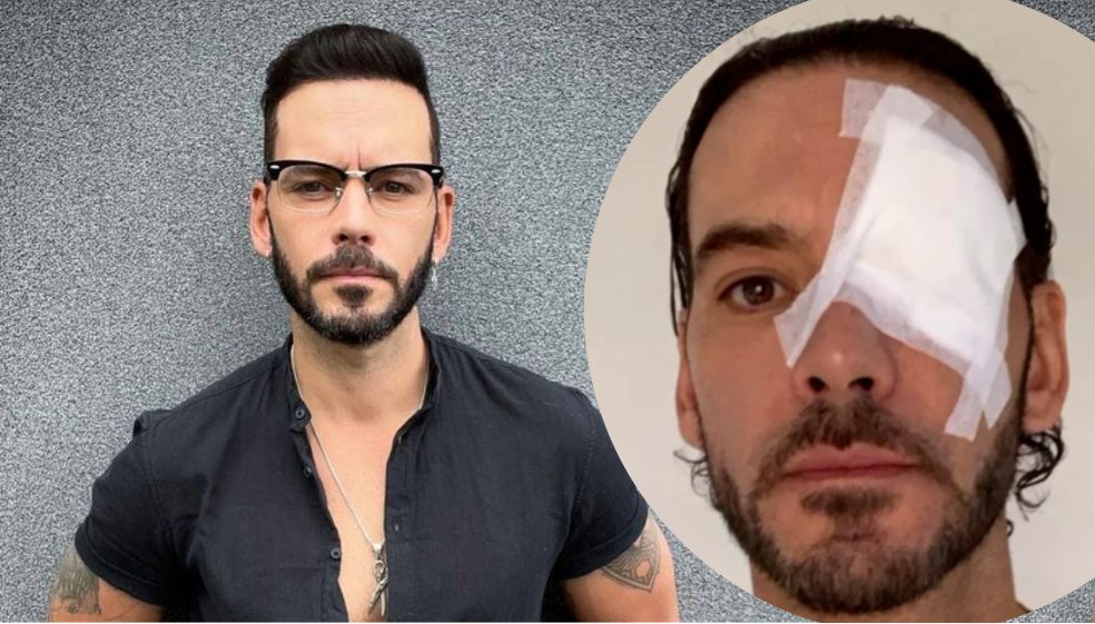 Diego Cadavid preocupó con fotos de las lesiones que le dejó este duro accidente