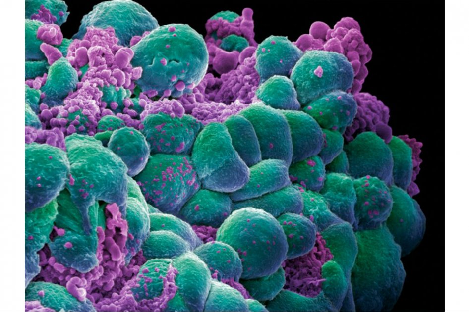 Cáncer, ¿cuestión de azar?