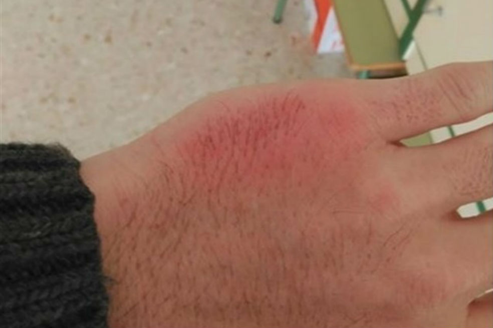 Profesor denuncia que fue agredido por alumno al evitar que le pegara a otro compañero