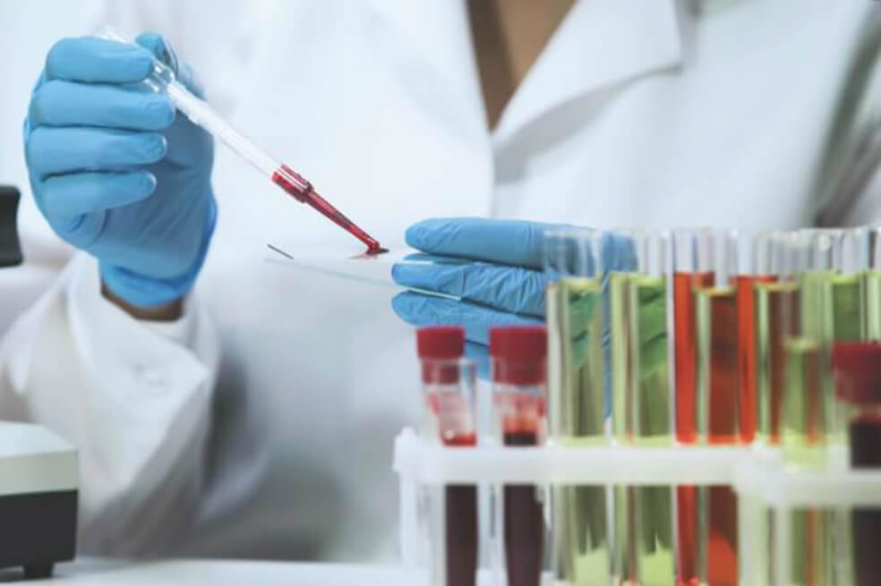 La esperada vacuna contra el VIH de Johnson & Johnson no es eficaz