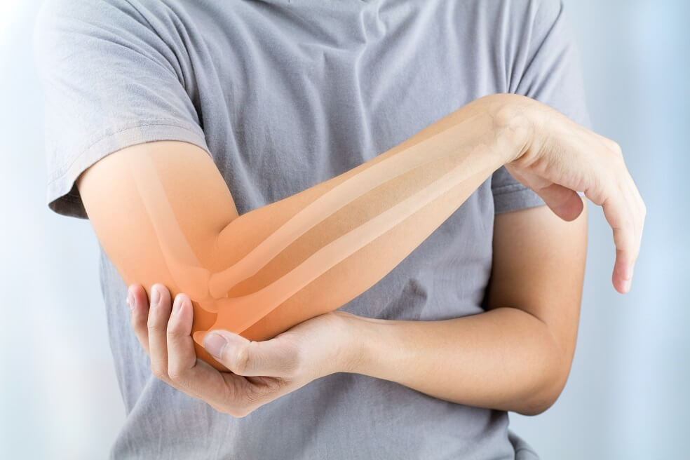 5 alimentos aliados si sufres dolor de articulaciones o de huesos