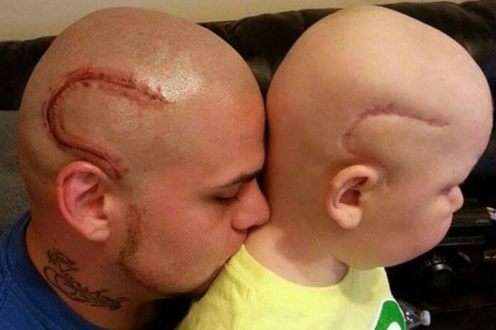El emotivo mensaje de despedida del padre que se tatuó la cicatriz de su hijo