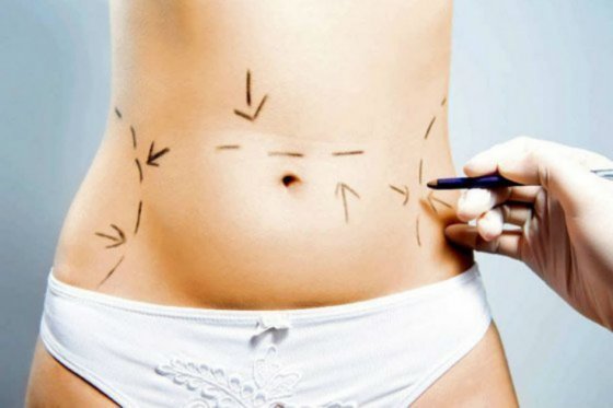 Avanza ley para prohibir que menores se practiquen cirugías de glúteos y senos