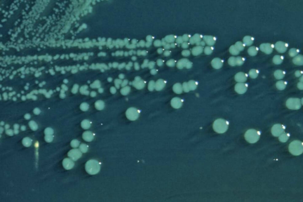 Aumenta resistencia en bacterias que causan diarrea en Latinoamérica