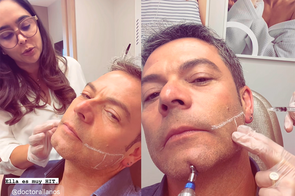 Iván Lalinde, de ‘Día a Día’, se inyectó bótox y mostró el proceso. Así quedó