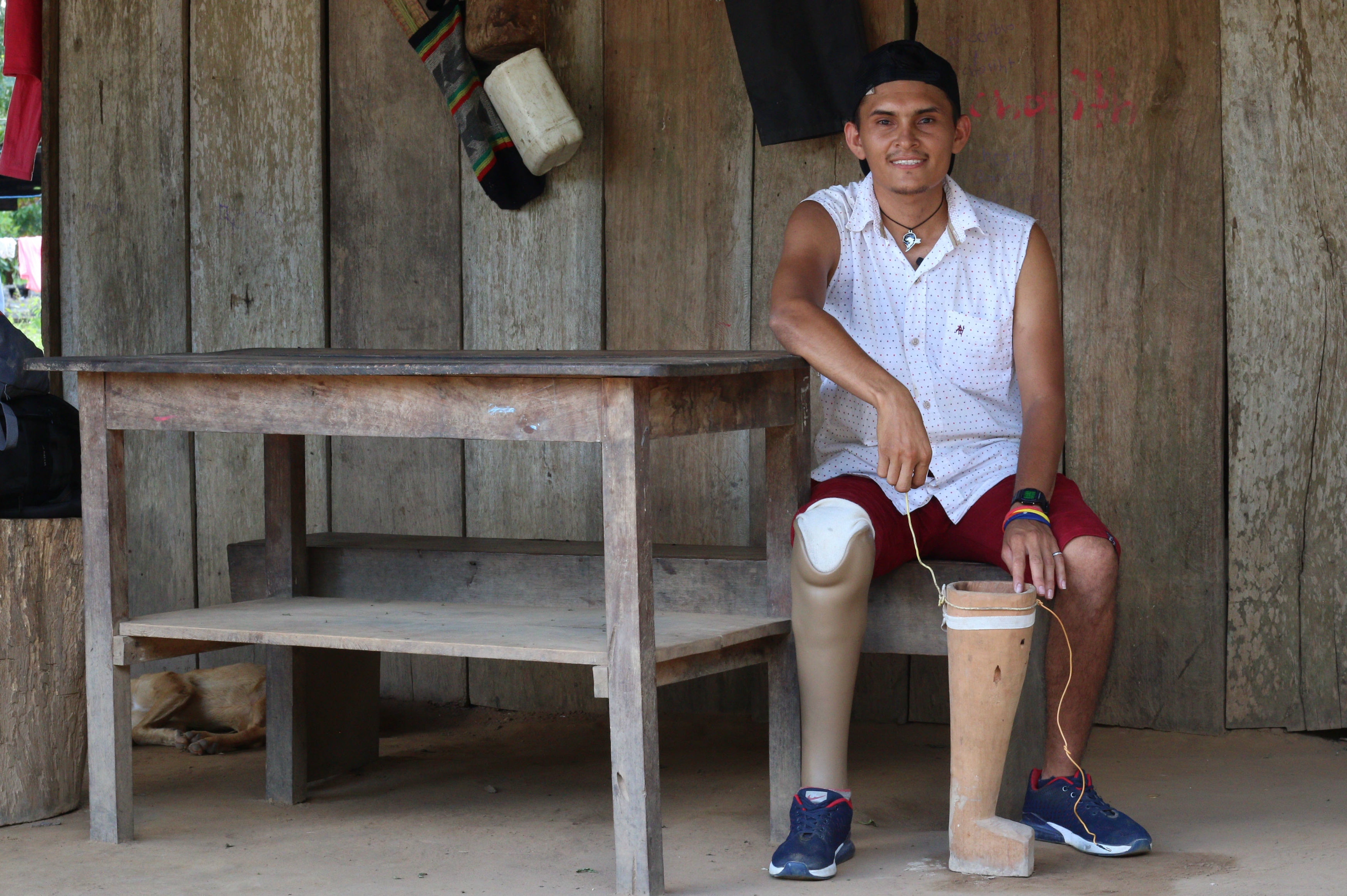 Diomedes Diaz, campesino víctima de un artefacto explosivo en zona rural de Arauca, en agosto de 2018. El Cicr le facilitó la prótesis y el acceso a rehabilitación física.