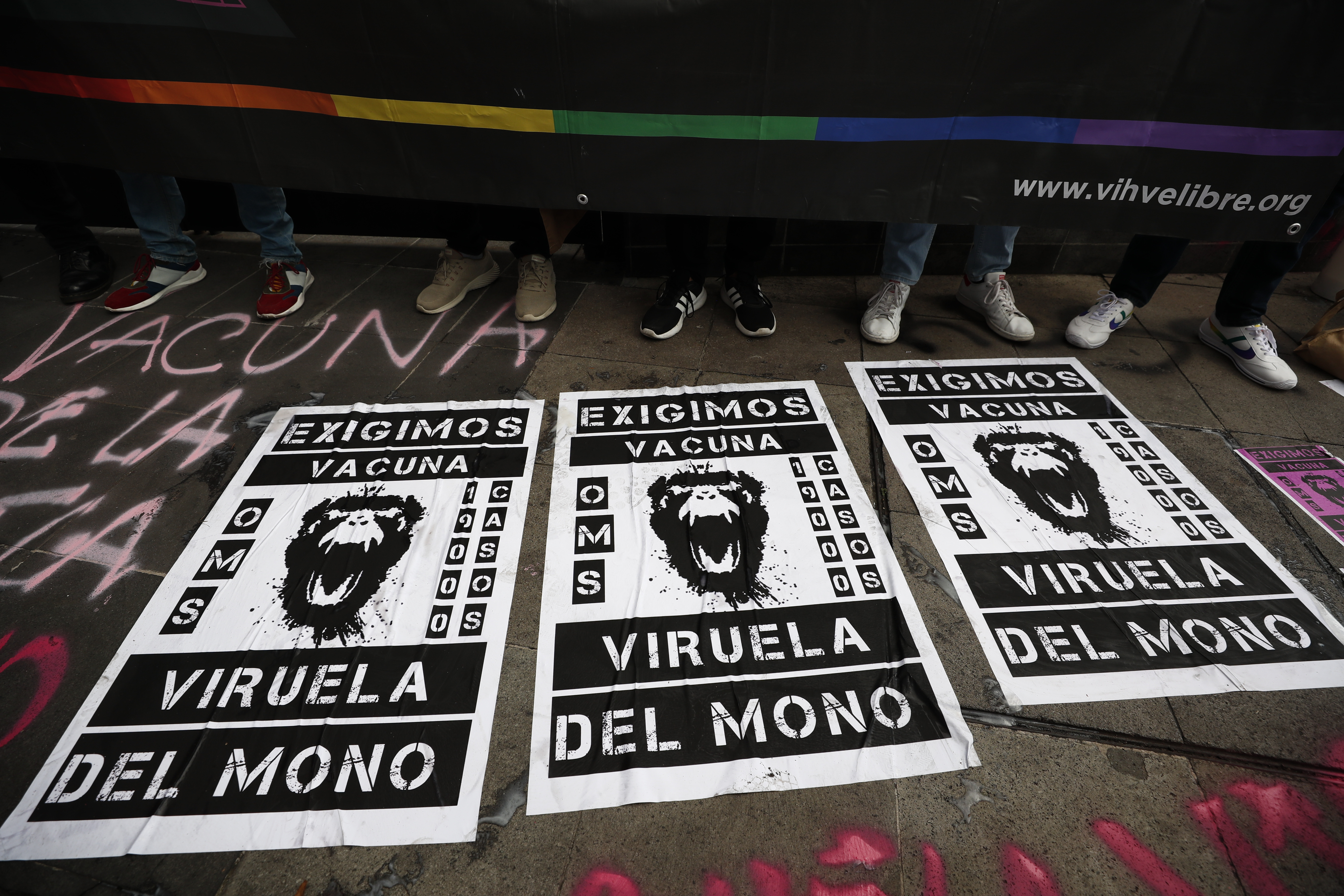 Viruela símica: un virus con estigma