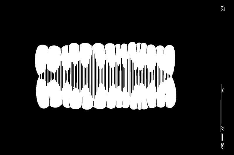 Audios