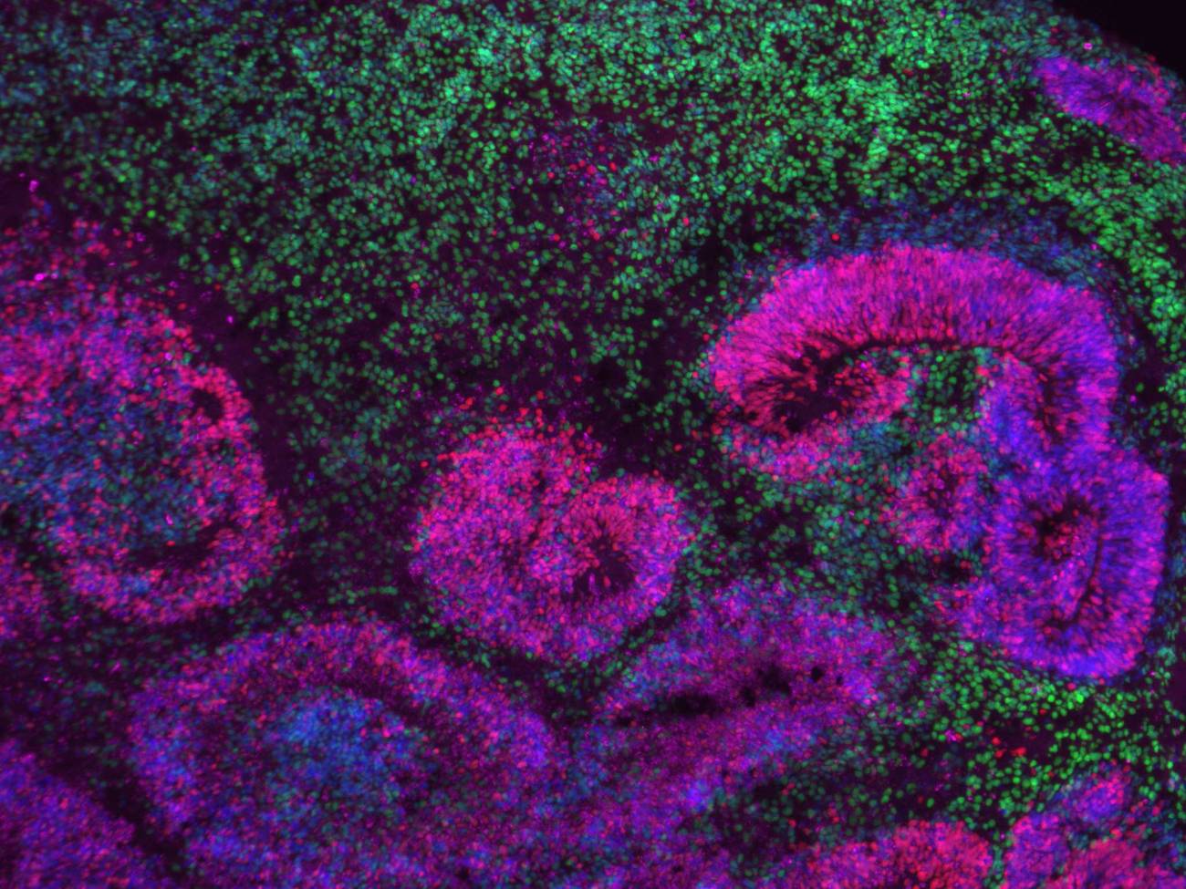 El mayor mapa del cerebro que revela cómo se originan enfermedades como el autismo