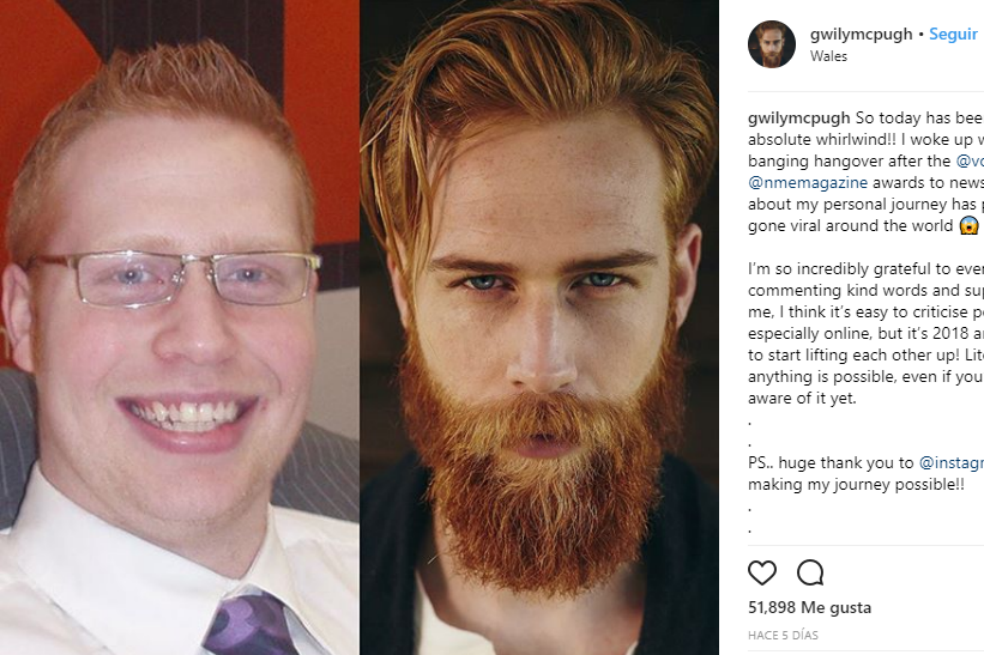 Gwilym Pugh, el hombre que bajó más de 40 kilos y se convirtió en modelo