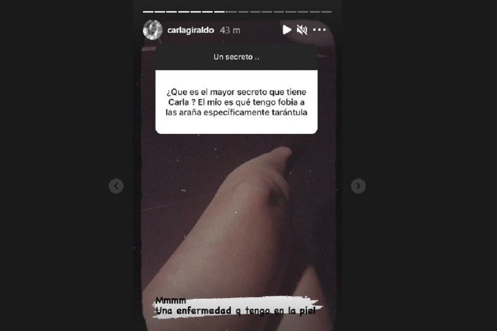 Carla Giraldo reveló que padece una enfermedad en su piel.