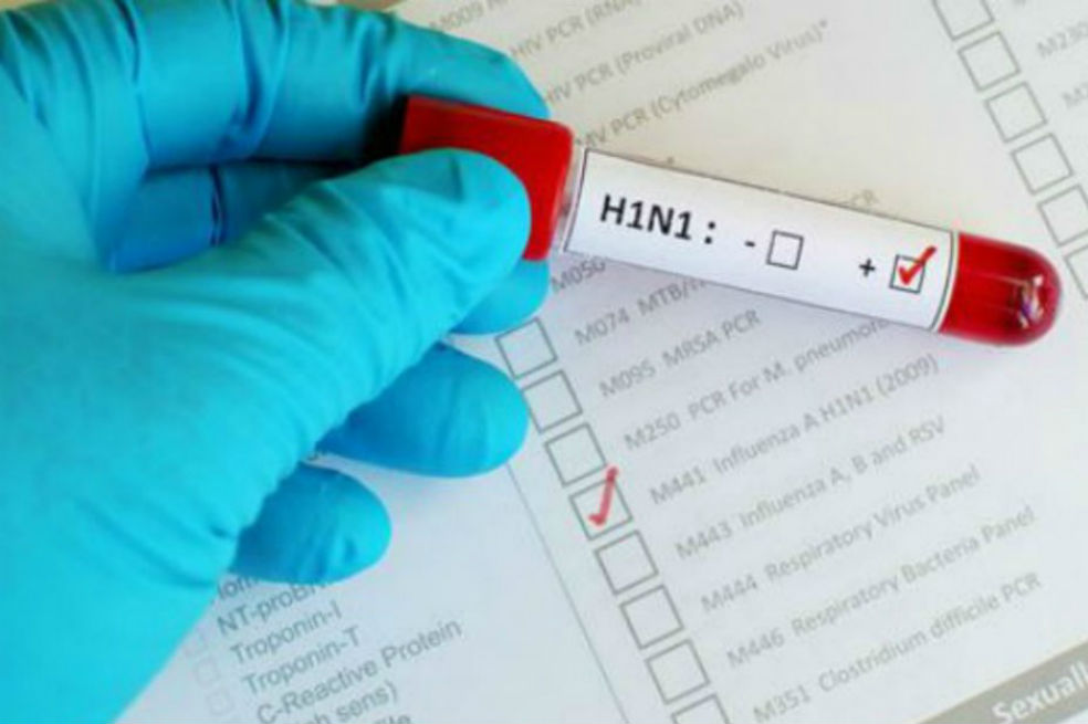 Confirman tres casos de influenza AH1N1 en Norte de Santander