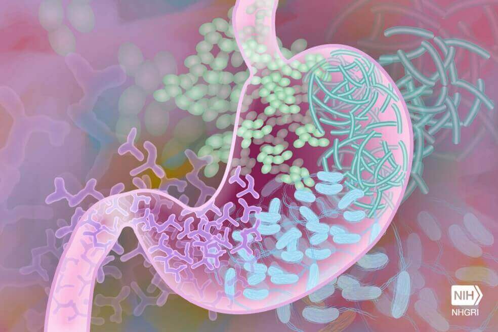 Así es como migrar a otro país afecta su sistema digestivo
