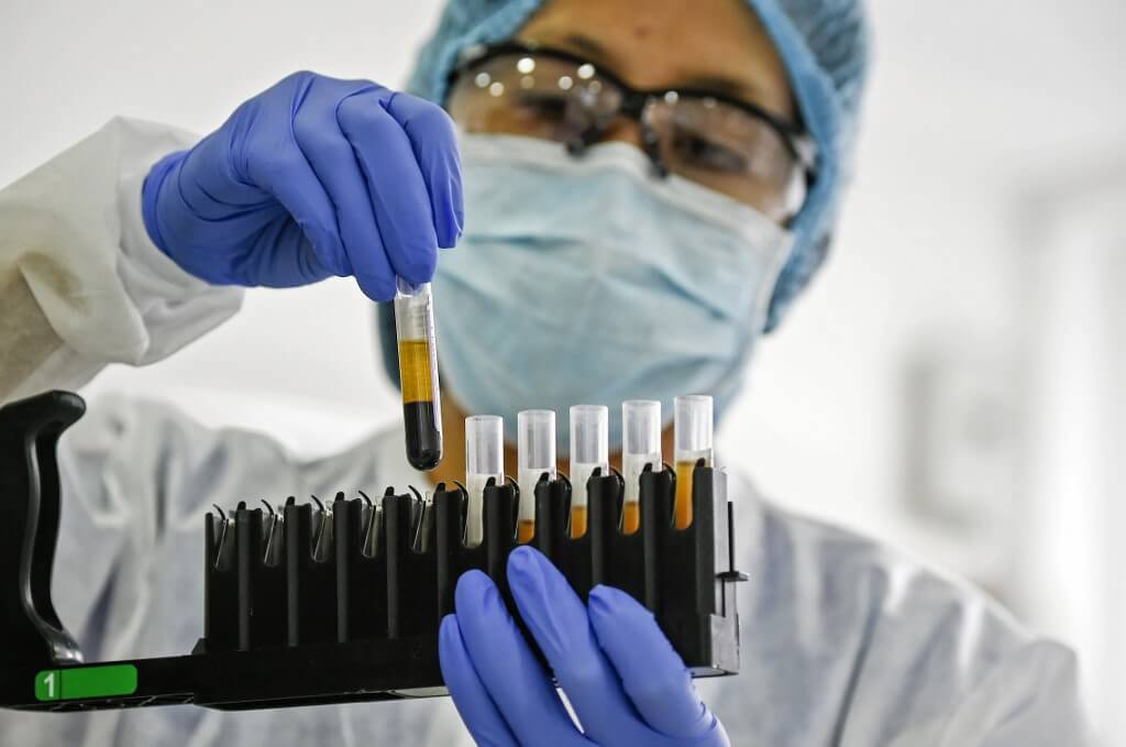 Triglicéridos altos: síntomas que puedes sentir en la piel y en el cuerpo
