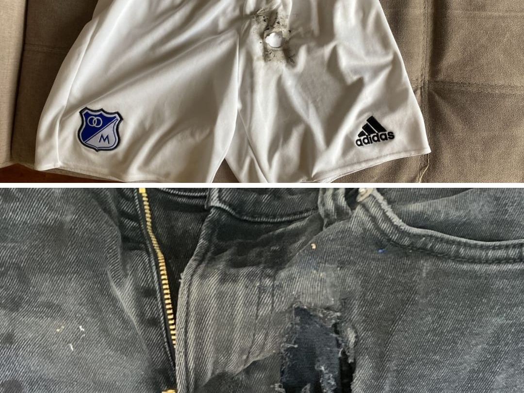 Así quedó la ropa de Juan Sebastián después del impacto de la bengala, fue lo único que pudo recuperar, ya que el saco y la camiseta se quemaron totalmente.