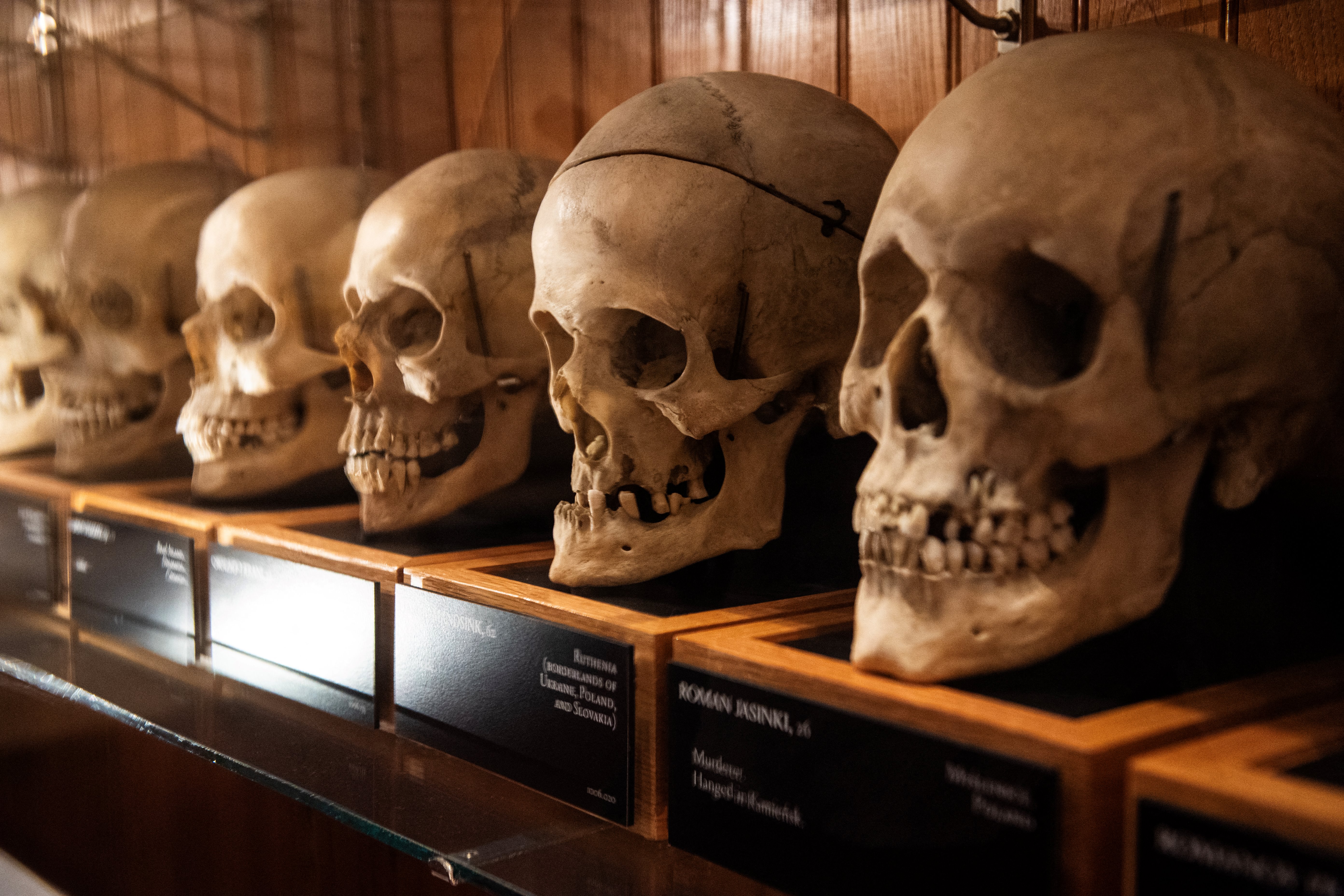 Museo de EE. UU. abre debate sobre cómo exhibir restos humanos
