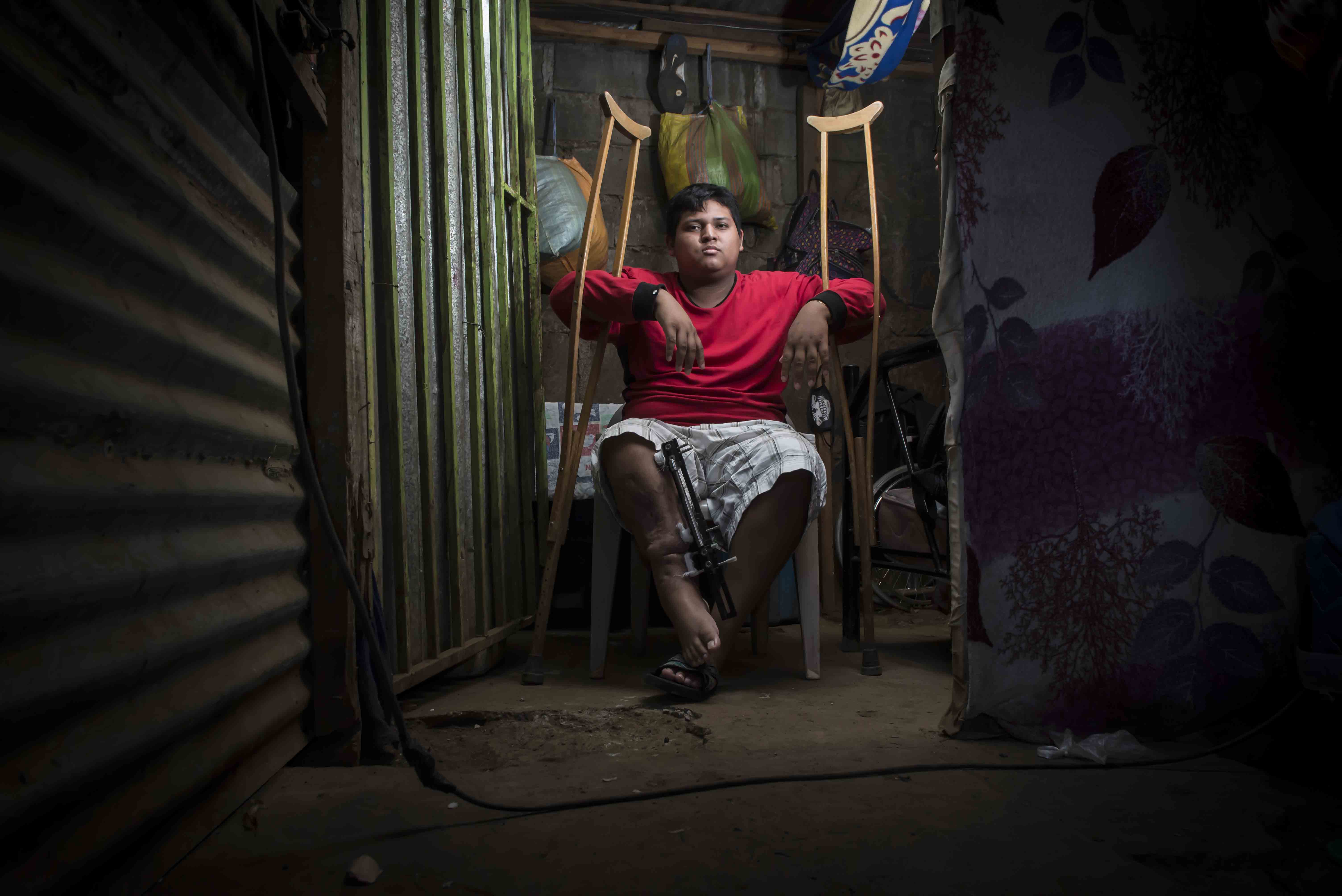 Isaac Ramírez vive con su madre en una pequeña casa con piso de tierra en un barrio de Managua. Esta foto fue tomada antes de que le amputaran la pierna. Foto: Óscar Navarrete