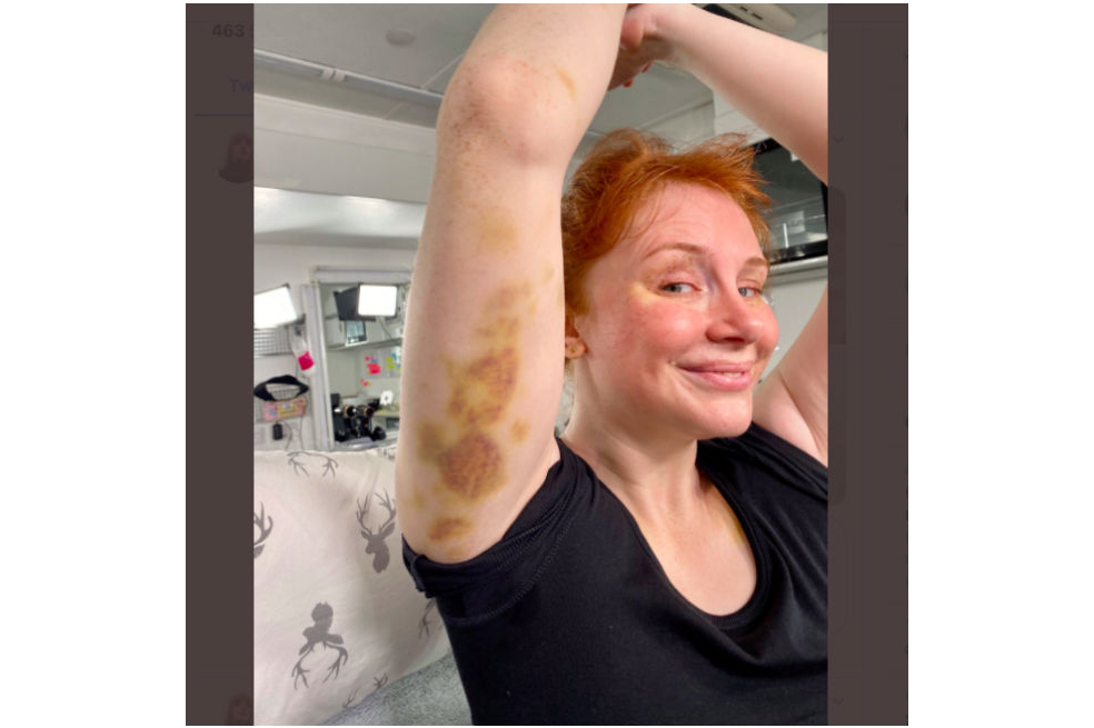 Así terminó Bryce Dallas Howard después de un día de rodaje de “Jurassic World 3”