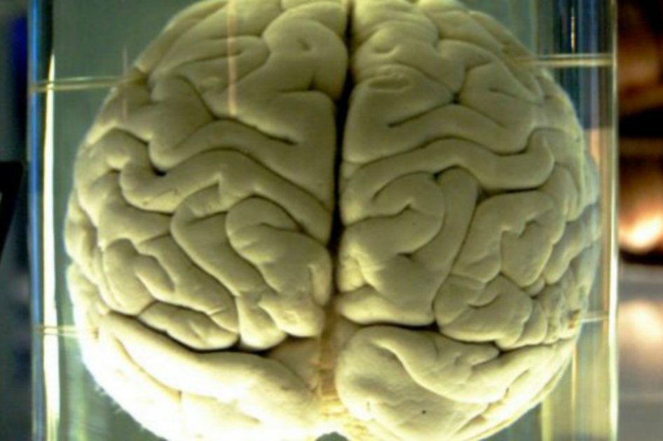 El experimento de un médico indio para resucitar a pacientes con muerte cerebral