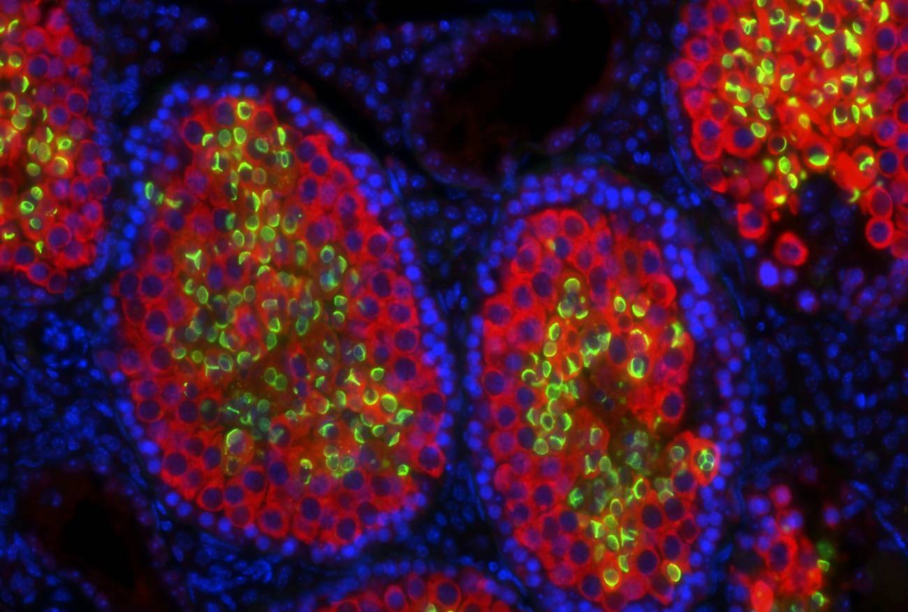Consiguen que ratones estériles produzcan esperma de rata
