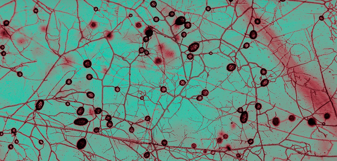 Primer mapa global muestra la inmensa red de hongos oculta en los suelos