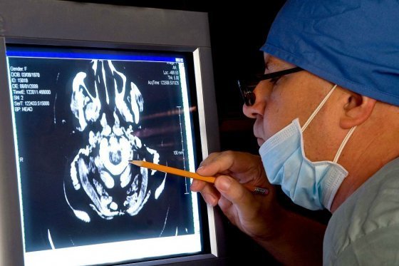 Identifican cambios tempranos en el cerebro de personas en riesgo de padecer alzhéimer