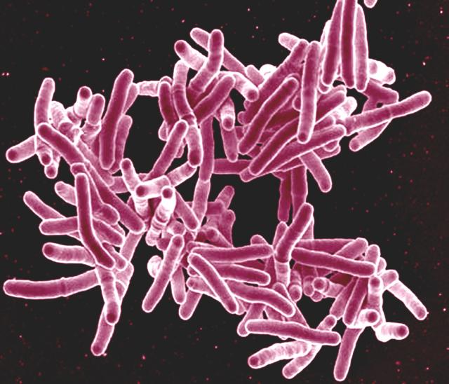 En busca de los genes de la tuberculosis que sufren los caldenses