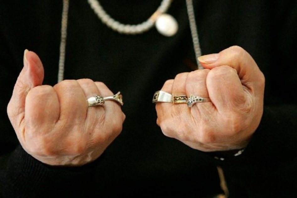 Este jueves es el día mundial de la artritis reumatoide