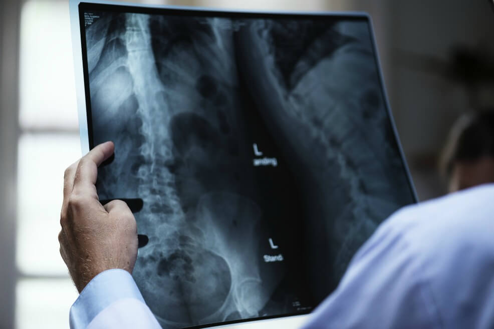 La infertilidad masculina y el cáncer de próstata podrían tener causas comunes