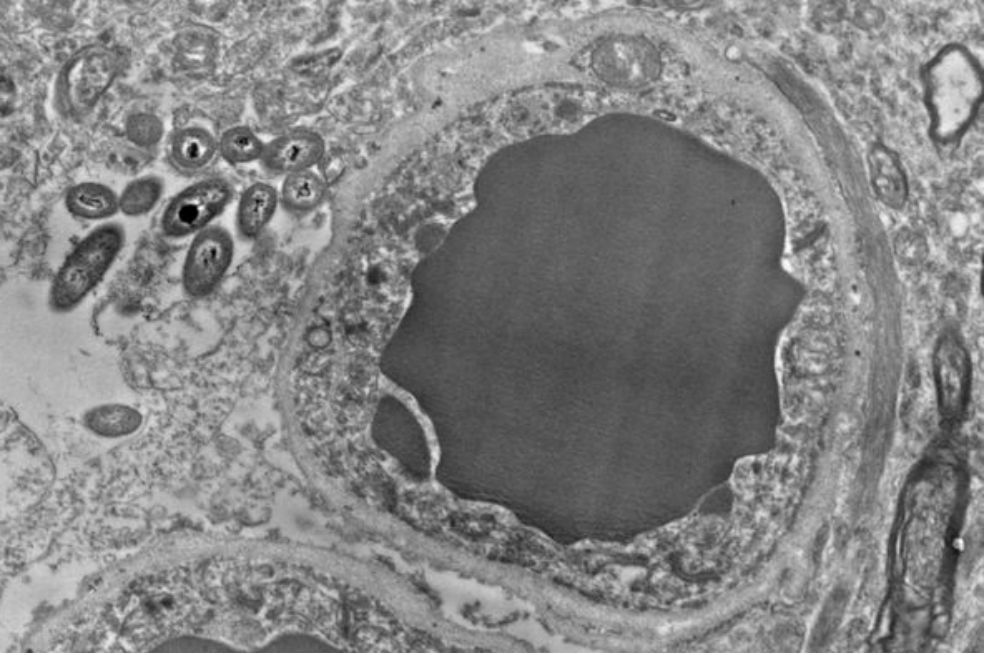 Cerebro: ¿el segundo hogar de las bacterias del intestino?