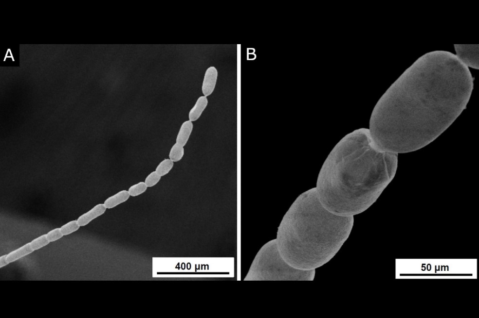 Esta es la bacteria más grande jamás descubierta