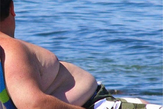 En Colombia más del 30% de la población sufre de obesidad