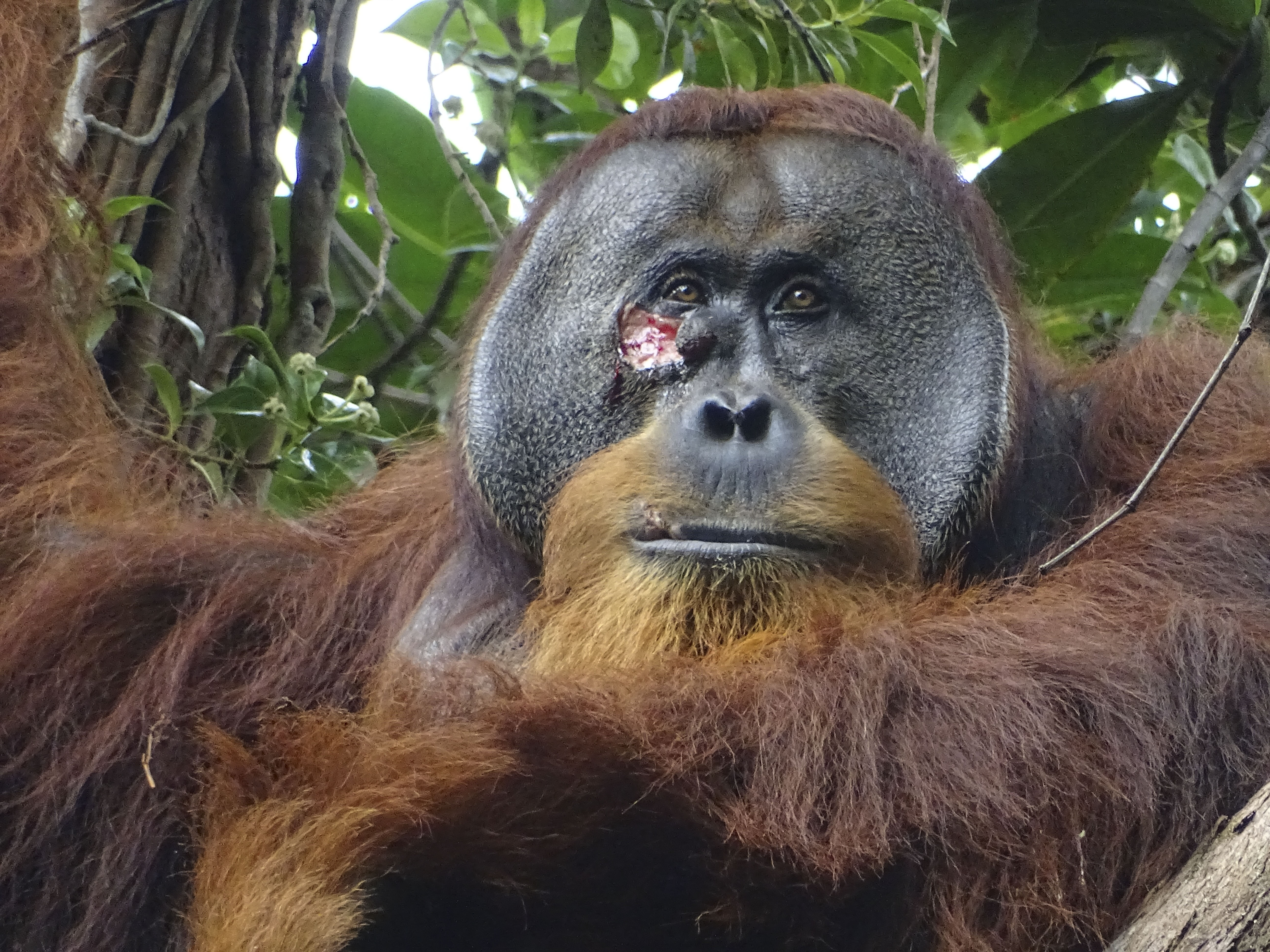 REDACCIÓN CIENCIA, 02/05/2024.- Fotografía del macho de orangután Rakus con una herida bajo el ojo. Rakus es un orangután macho de Sumatra (Pongo abelii) que sufrió una herida debajo de uno ojo y sobre la que se aplicó una planta de conocidas propiedades medicinales, un comportamiento que es la primera vez que se observa en un animal salvaje. EFE/ Armas / Suaq Project SOLO USO EDITORIAL SOLO DISPONIBLE PARA ILUSTRAR LA NOTICIA QUE ACOMPAÑA (CRÉDITO OBLIGATORIO)