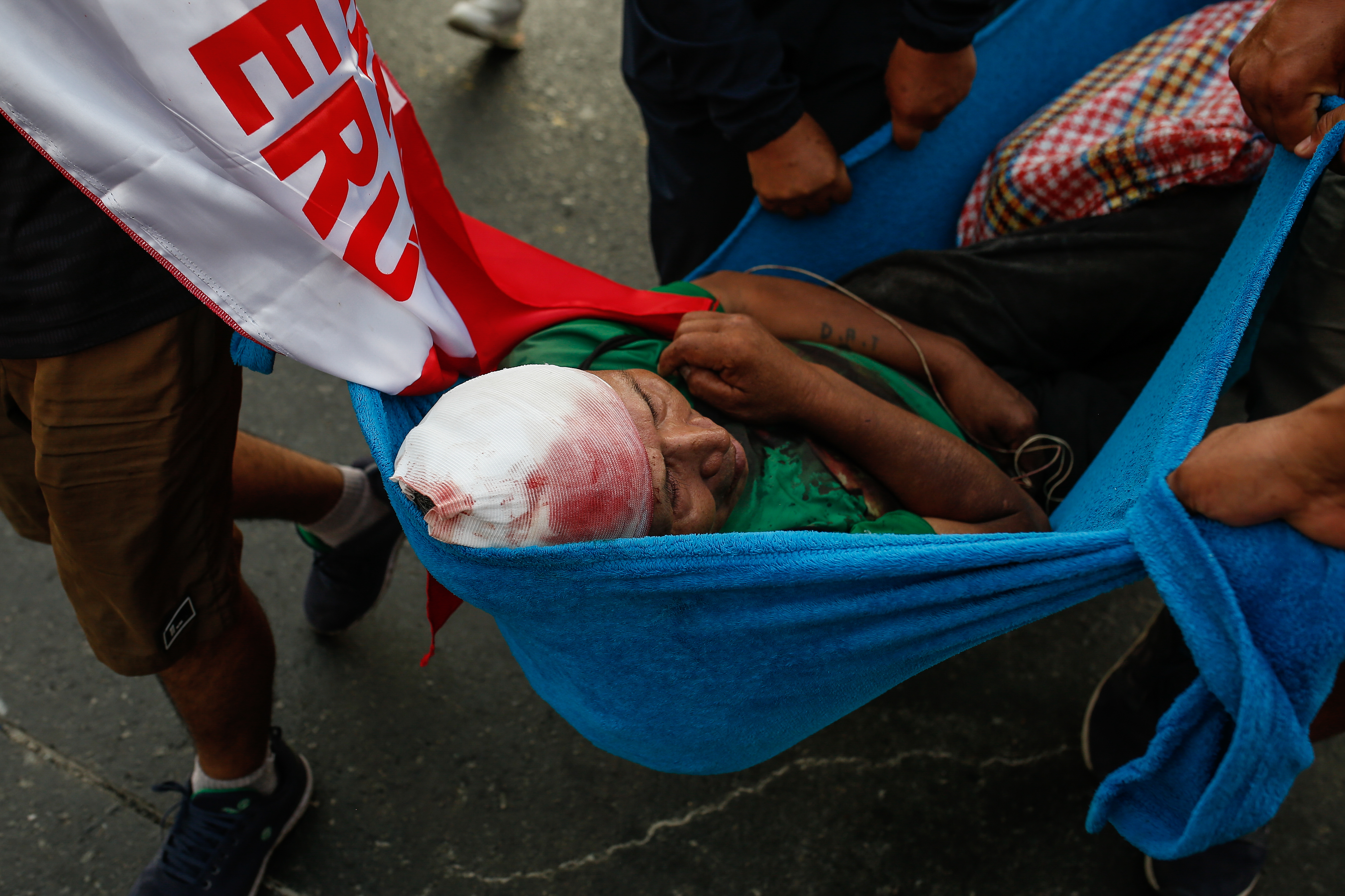 AME7303. LIMA (PERÚ), 19/01/2023.- Varios manifestantes trasladan a un herido durante la llamada "toma de Lima" hoy, en Lima (Perú). Miles de peruanos venidos de diversos puntos del país se congregaron este jueves en la capital en la denominada "toma de Lima", para exigir la renuncia de la presidenta Dina Boluarte, el cierre del Congreso y expresar su hartazgo por el olvido del Estado que consideran que padecen. EFE/ Renato Pajuelo