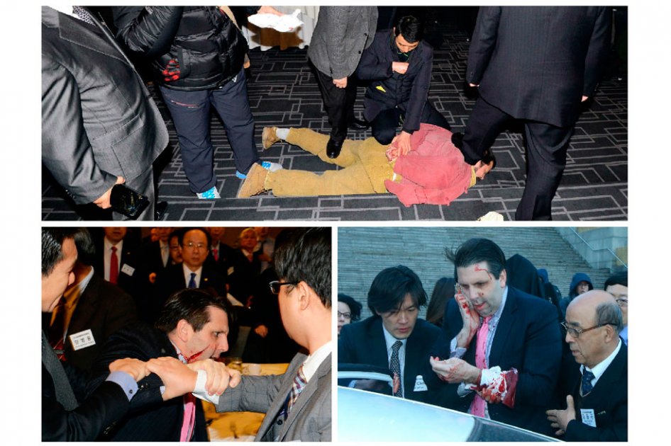 Policía surcoreana registra vivienda del agresor del embajador de EE.UU.