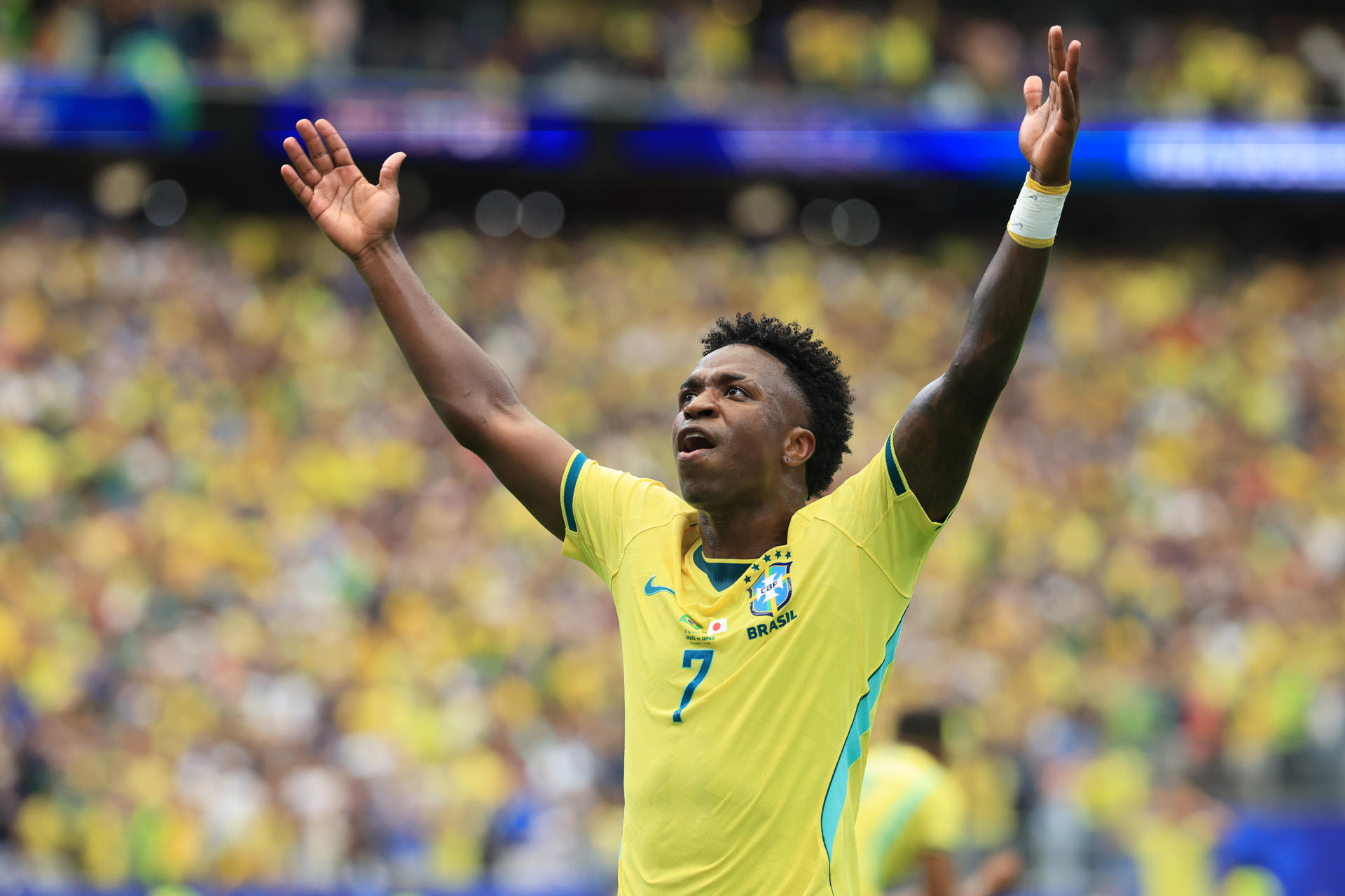 Vinícius Jr. sorprende con su nuevo rostro: así luce tras someterse a procedimiento estético
