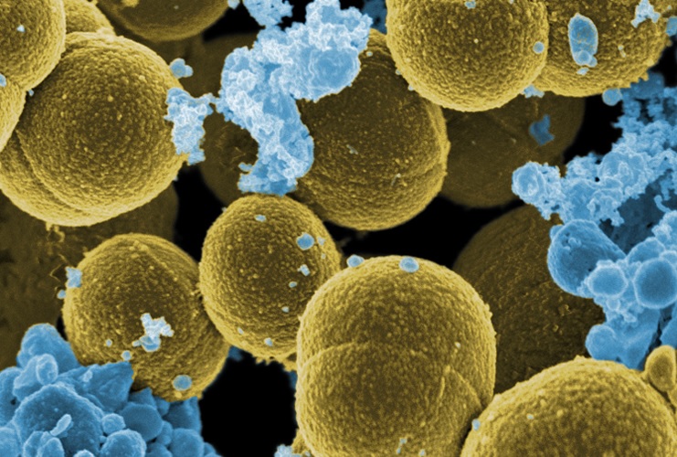 Resistencia a los antibióticos: se esperan 39 millones de muertes en 25 años