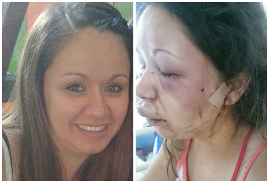 Dejan libre a hombre que le desfiguró la cara a su esposa