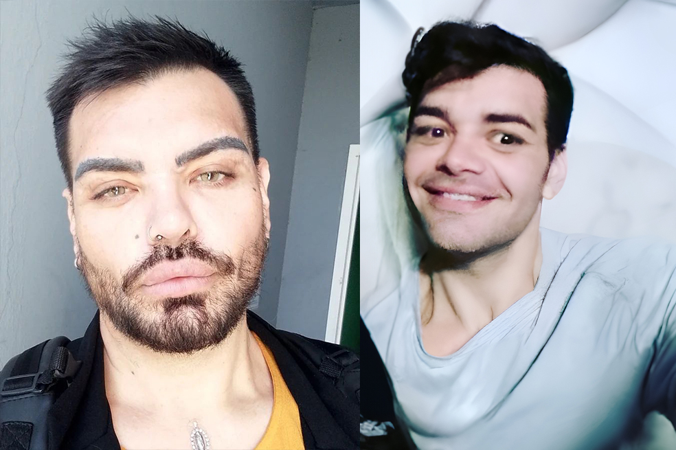 Así se veía antes el modelo que lleva 30 cirugías para parecerse a Ricky Martín